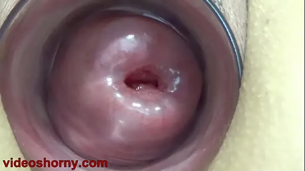 Vidéos cervix putain uterus pompe prolapsus et t. chatte maltraitee et tourmentee clips populaires