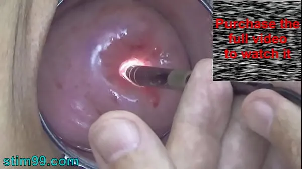 Vidéos Une caméra endoscopique dans le col de l'utérus regarde à l'intérieur de mon ventre et de mon vagin. Examen des tests d'inspection de l'épouse par un médecin gynécologue extrême clips populaires