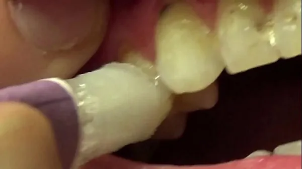 Applying Whitening Paste To Her Filthy Teeth clip hấp dẫn Video