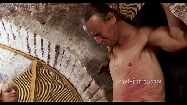 Sıcak Painful Red Bruises on Poor Guy's Flesh klip Videolar